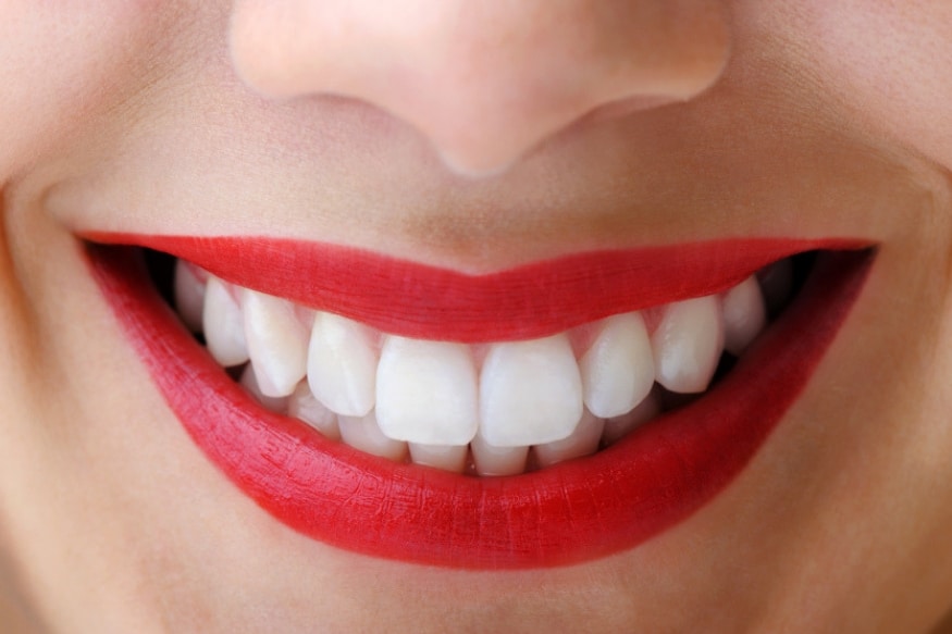 Home Teeth Whitening Tips Hindi