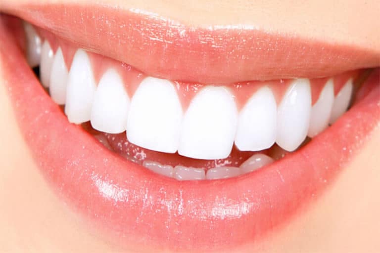 दांतों को कैसे चमकाएं घरेलू उपाय | दांतों को चमकदार कैसे बनाएं